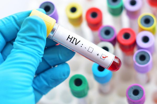 19 yıl sonra yeni HIV türü...