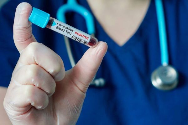 Türkiyede corona virüsten can kaybı 75 oldu