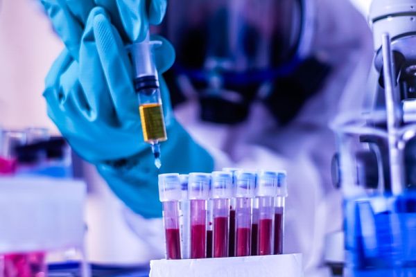 Haziran ortasından itibaren düşüş bekliyoruz